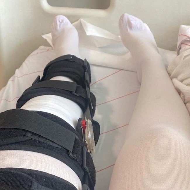 gusholderhaber's tweet photo. Antalya'da spor yaparken sağ dizinden sakatlanan kadın, gittiği özel hastanede yanlışlıkla sol dizinden ameliyat edildi. 

Şok geçiren mağdur kadın, sorumlular hakkında 2.000.000 TL'lik tazminat davası açtı. https://t.co/Zxq49rg4KM