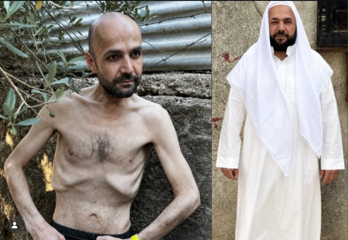 MichaelTLester's tweet photo. My entire book is about why people have difficulty accepting facts that conflict with their beliefs.

His name is Ayman Al-Fakhouri. He is from Hebron. The before and after photos are documented and widely reported by Drop Site News and Quds News.

This is not disputed. The only question is whether you care.