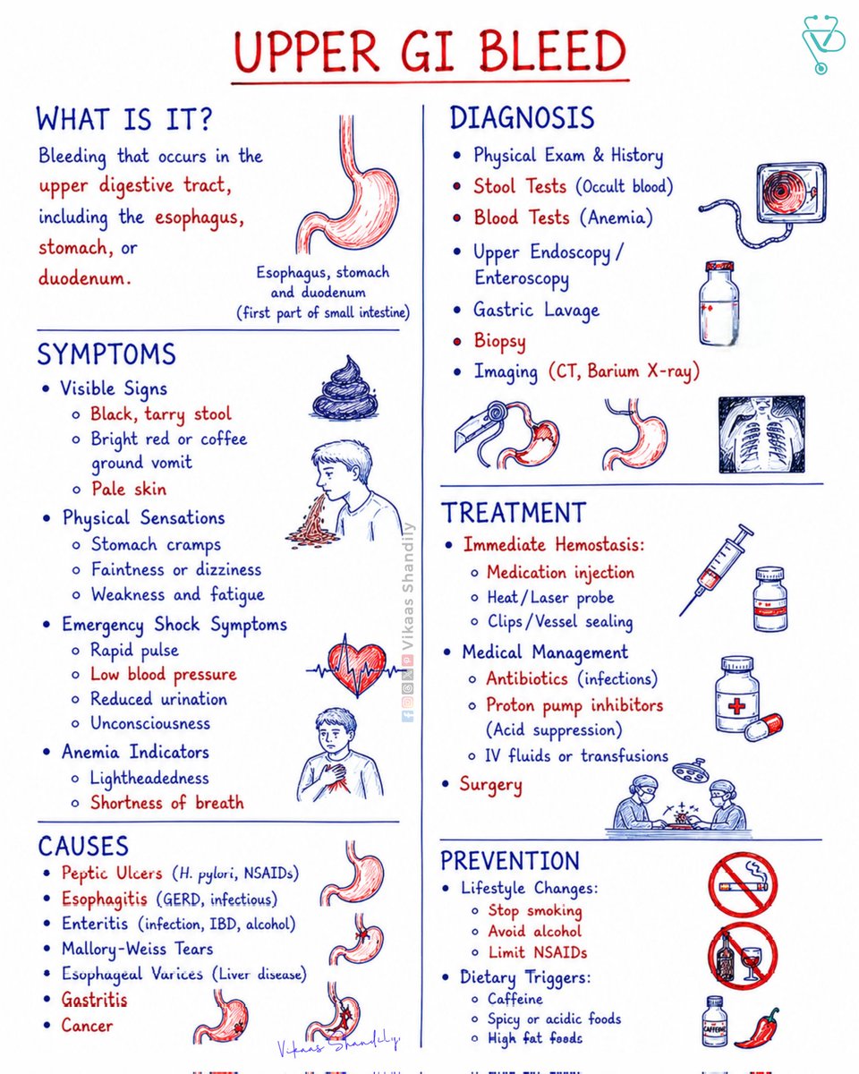 VikaasShandily's tweet photo. Upper Gastrointestinal Bleeding: Recognizing a Potential Medical Emergency
#UpperGIBleed #VikaasShandily #PepticUlcerDisease #Gastroenterology #Endoscopy https://t.co/3sjtwwIaPf