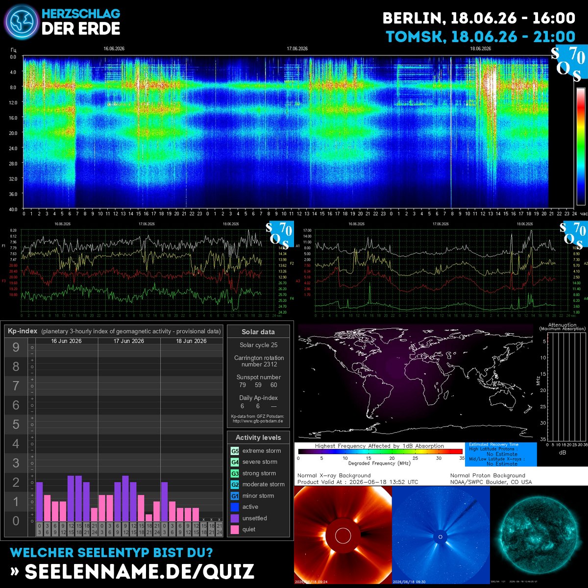 SchumannBotDE's tweet photo. 🌍✨ Earth's heartbeat pulses with cosmic energy today! The Schumann resonance dances as solar winds embrace our planet—feel the connection, trust the flow. 💫 #CosmicEnergy #Schumann #SolarWisdom https://t.co/lNVeS1uSHa https://t.co/xGLThcJuLi