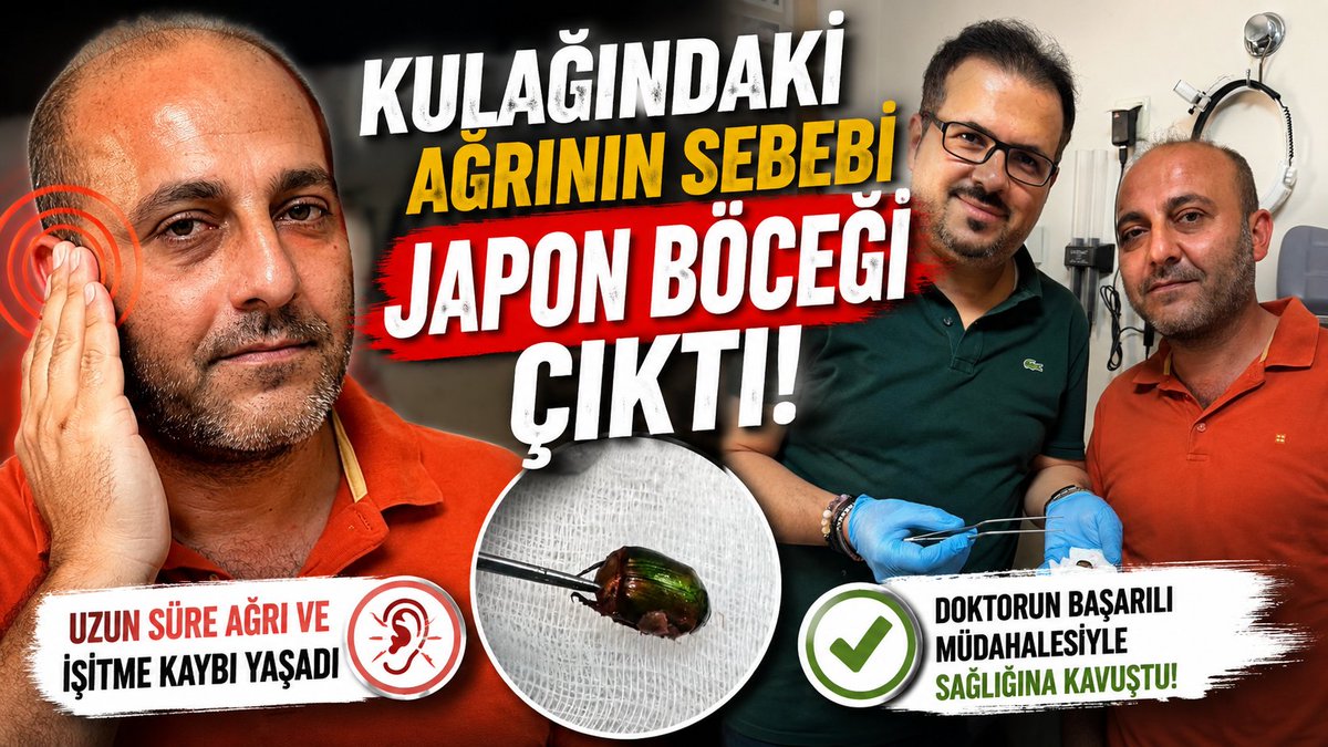 RTCHABER's tweet photo. Kulağındaki Ağrının Sebebi Japon Böceği Çıktı
Alaşehirli Çiftçinin Kulağından Japon Böceği Çıkarıldı
https://t.co/xxLtKIdD8r
#haber #haberler #gündem #sağlık #izmir https://t.co/t32DRWo7Q4