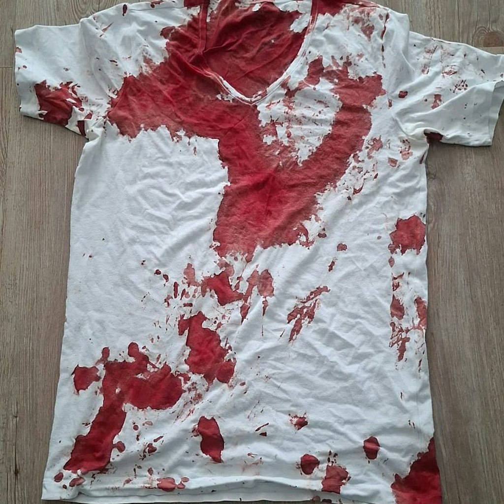 KHermansa's tweet photo. @welt Mordanschlag auf AfD - Politiker in Rostock. Der Laptop im Rucksack rettete sein Leben. https://t.co/R4ZmCdaLKF