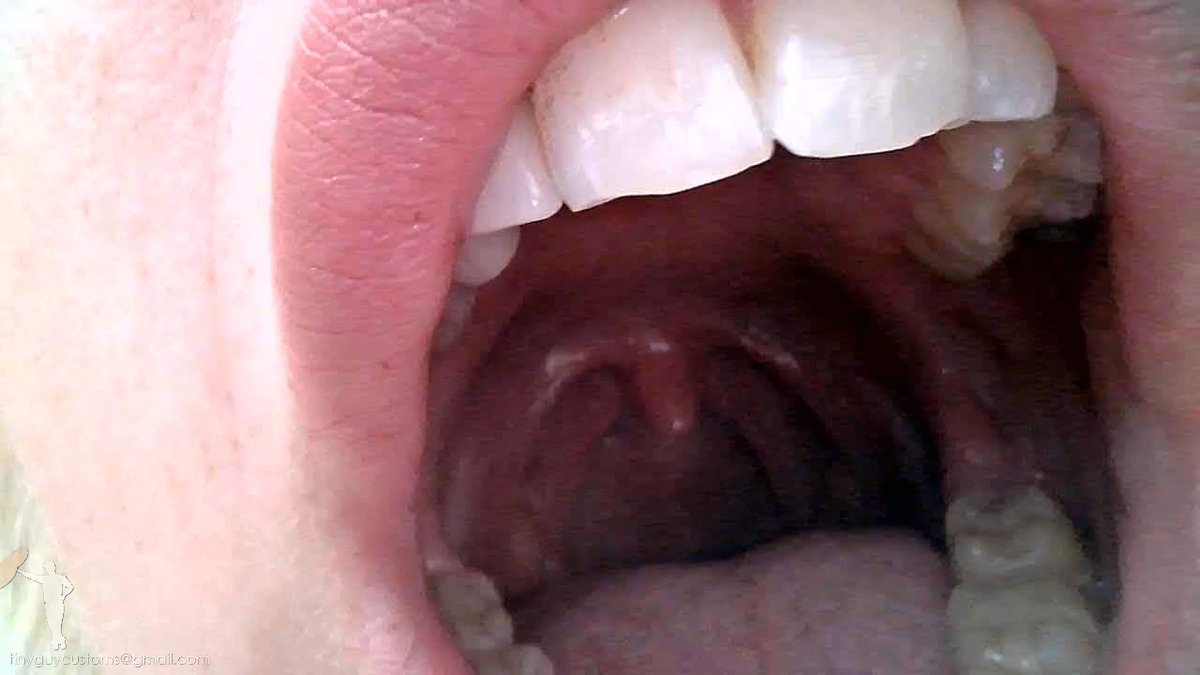 TinyGuyCustoms's tweet photo. Just admit it... This is what you've always wanted... 😁 

#Vore #Fetish #Shrinking #Mouth #Uvula #Swallowed #TinyGuyCustoms https://t.co/yjjZiQ0rFi