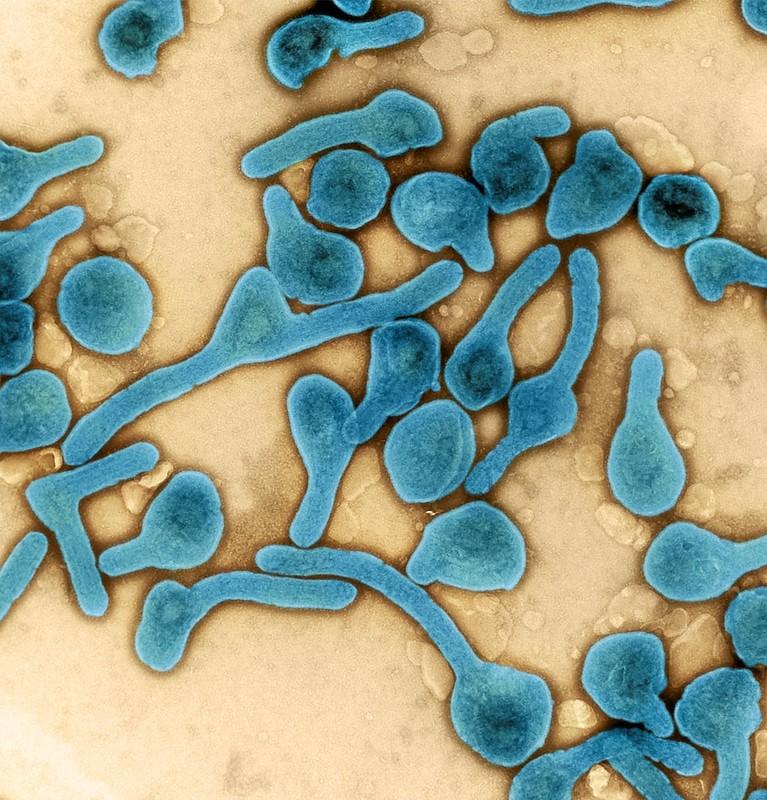 CIDRAP's tweet photo. Ebola cases near 900 as officials say less than 10% of donations have made it to affected nations

The US CDC announces it will release $107 million to fight the outbreak.

Read more: https://t.co/yQTyDAXLrT

📷: NIAID https://t.co/m39pIv4Dgb