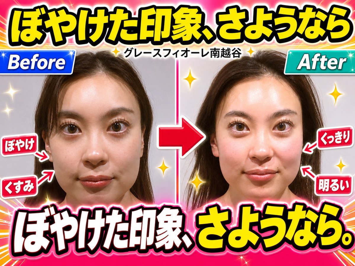 gracefiore44084's tweet photo. 20代、夏前に、変わりましょ。
南越谷の小顔矯正でお待ちしています。 https://t.co/KV2Jr3PWRw