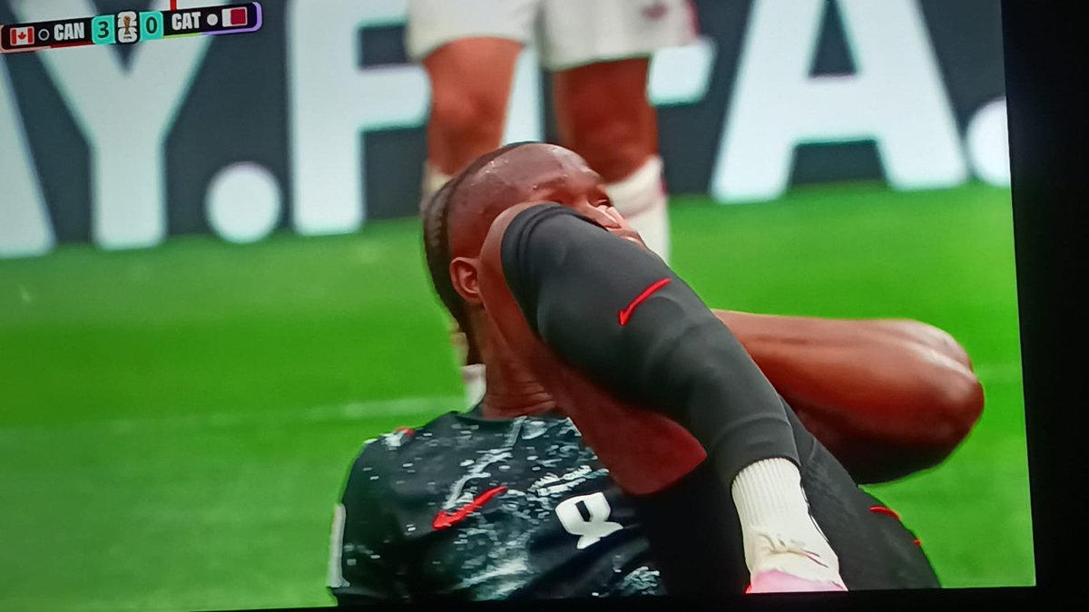 nahfreitas42's tweet photo. Primeira lesão grave na Copa do mundo: Uma fratura exposta do Koné do Canadá. 

Uma fratura de tibia e possivelmente fíbula também. 

#CopaNaCazéTV
⬇️⬇️ https://t.co/Qnu7bX2uoD