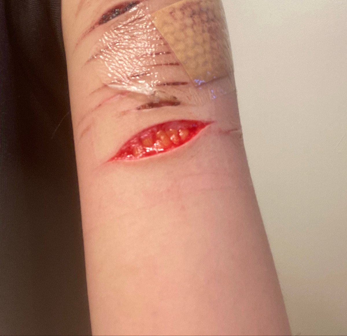 Violet620360911's tweet photo. It’s so beautiful. I want to make an even longer one but on my thigh. Been cutting for a week straight so I kept putting off showers. Need to take one today… #beanstwt #slittwt #shedtwt #shtwt https://t.co/bRKvtHGHMl