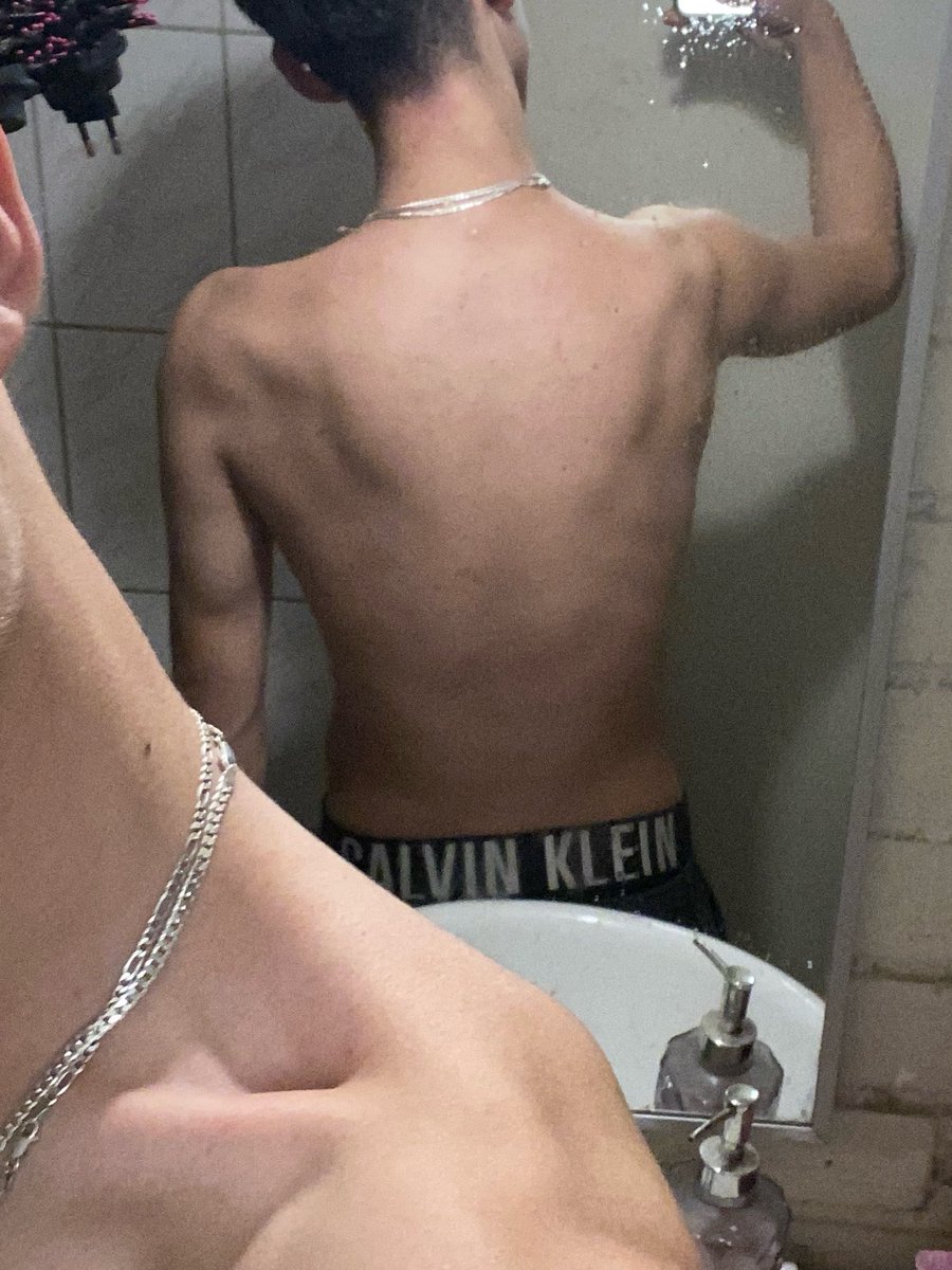 shiritokieff's tweet photo. Mi espalda y gym en un tiempo mas sera como juguete q rascan los gatos 😝 https://t.co/cO91Ydf3O5