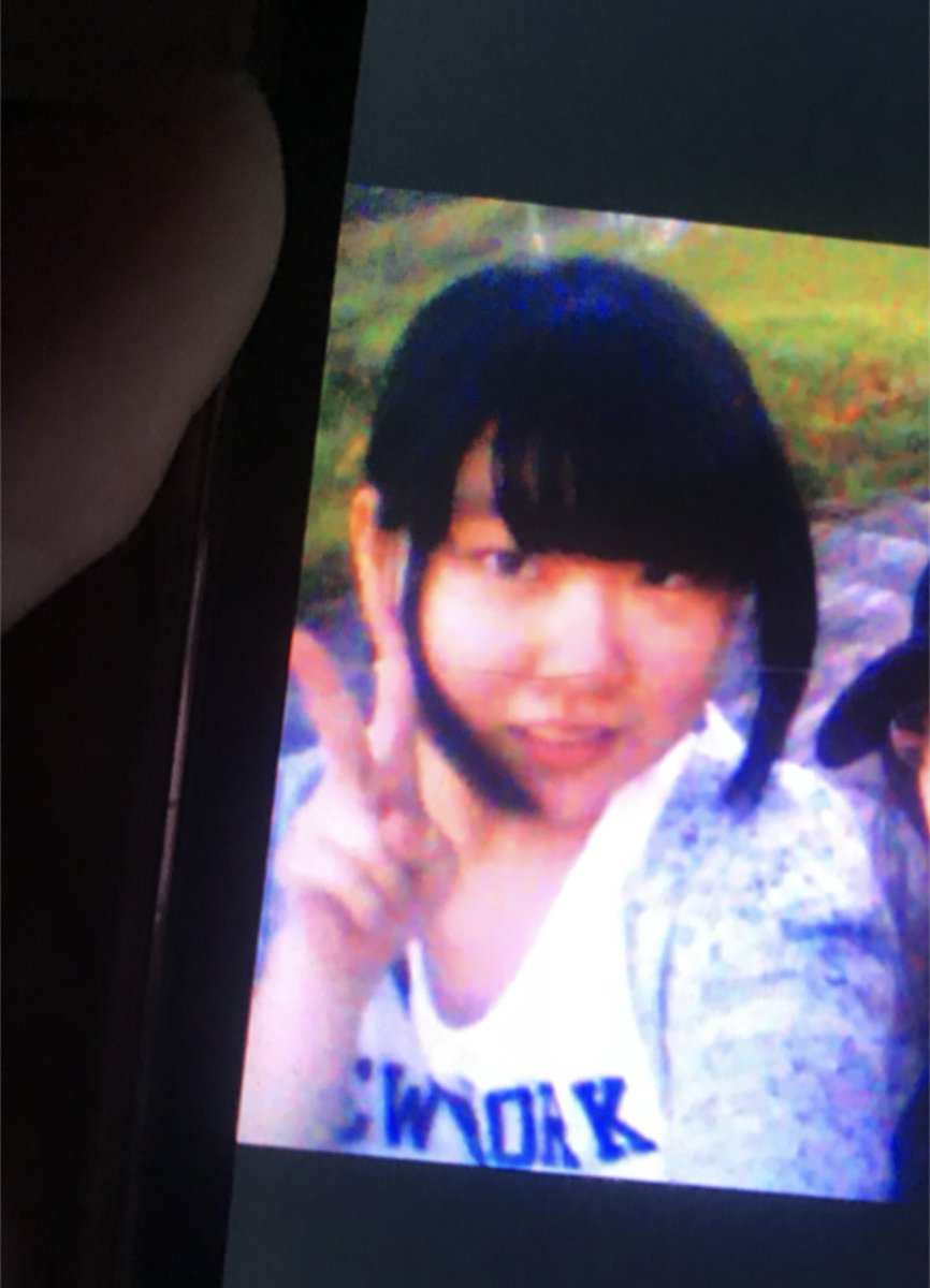Cinderella__m_'s tweet photo. 15歳でこの整形はセンス。 https://t.co/RKyclYlUwO