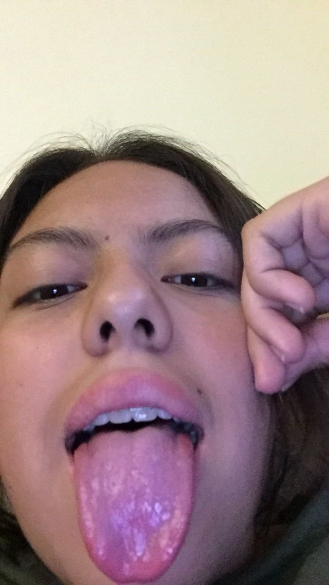 ch1sson1's tweet photo. Since you guys like when I open wide https://t.co/5YuDRE7cRu