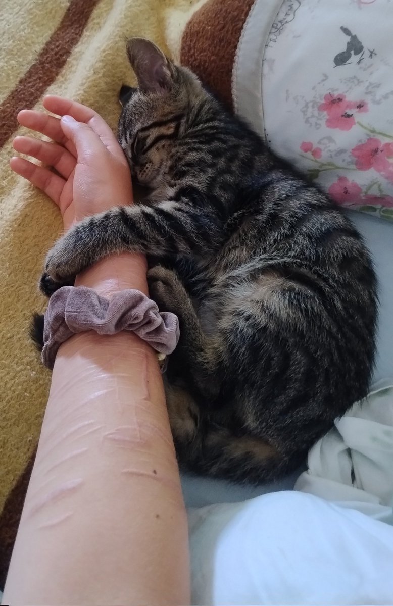 Sam_ratri's tweet photo. @didntdigest I get you, i have both arms covered in scars and it's not easy to wear long sleeves bc you get treated differently.
What helped me was to not tolerate people who'd comment/judge on them unless with genuine curiosity and care.
But if they stare occasionally is understandable imo. https://t.co/BJs9NDsNIv