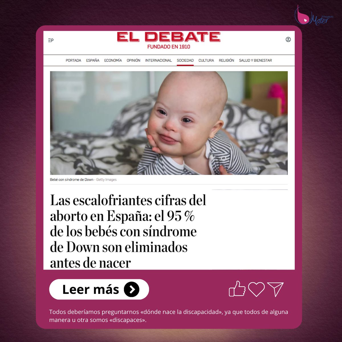 ProyectoMater's tweet photo. Cada vida humana tiene un valor infinito, único e irrepetible. Ver que tantas vidas se apagan antes de nacer por un diagnóstico nos obliga a reflexionar: ¿qué mundo estamos construyendo?

#SíALaVida #CadaVidaCuenta https://t.co/r7EXbE4IvH