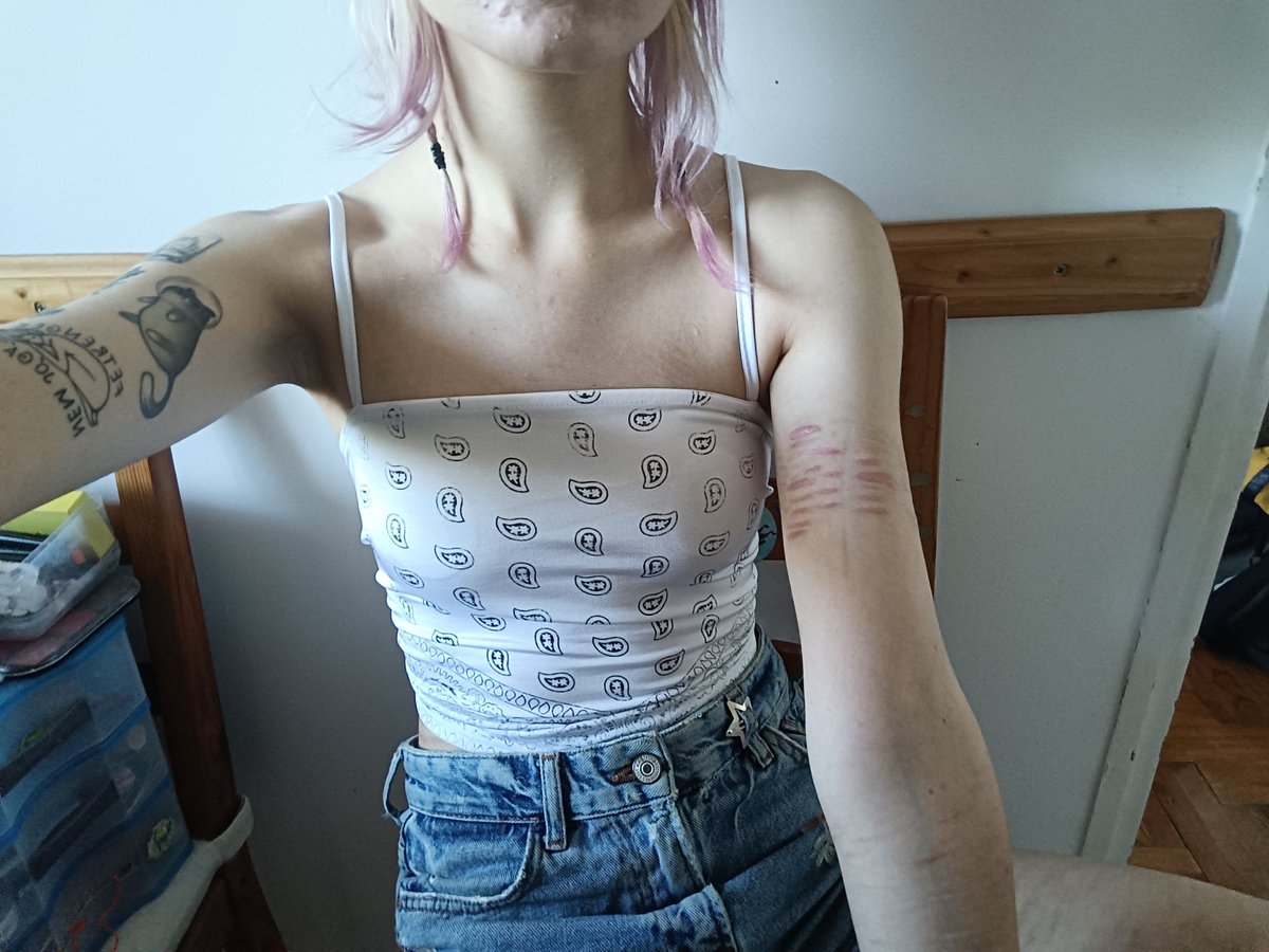 dzsolyi's tweet photo. going to balaton lake today with my friends. we're gonna drink a LOT!!
almost all my scars are exposed so im very scared, i know they wouldnt hurt me but im still scared. my other issue is eating. like no i dont want to eat 3x a day, id rather not eat at all or on every 2nd day. https://t.co/1q3Dq1O51C
