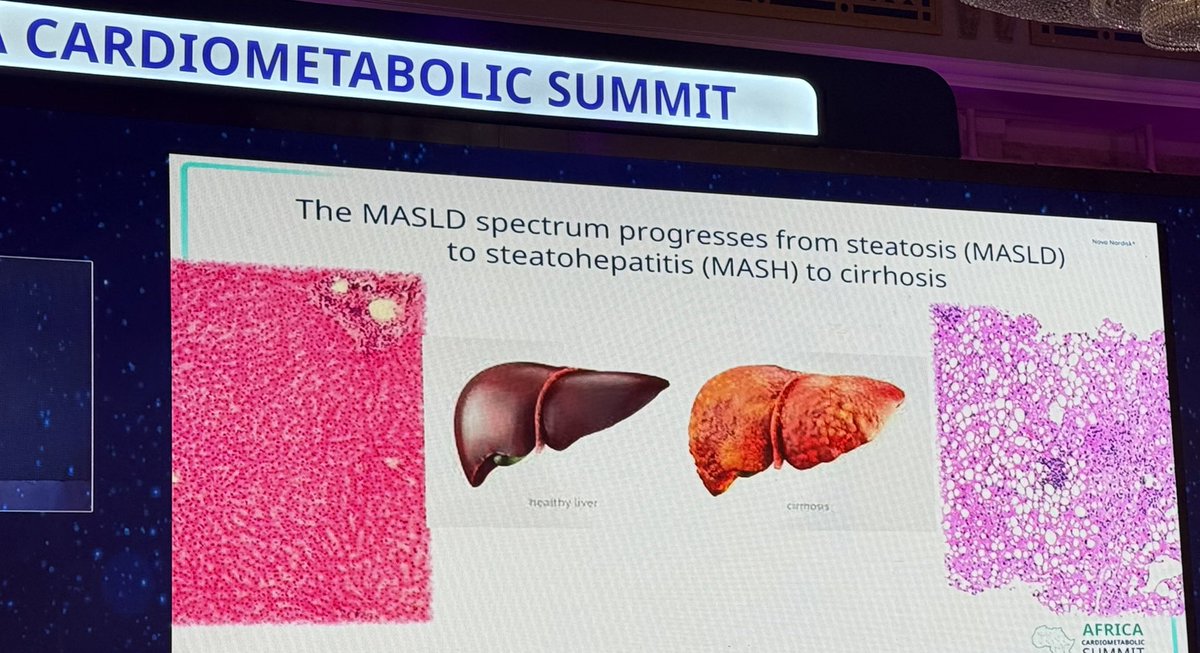 aphilecomms's tweet photo. If your waist circumference is more than half your height (0.5) ✍️✍️#ActNow #CMSummit #FattyLiver https://t.co/k5x4svnppl