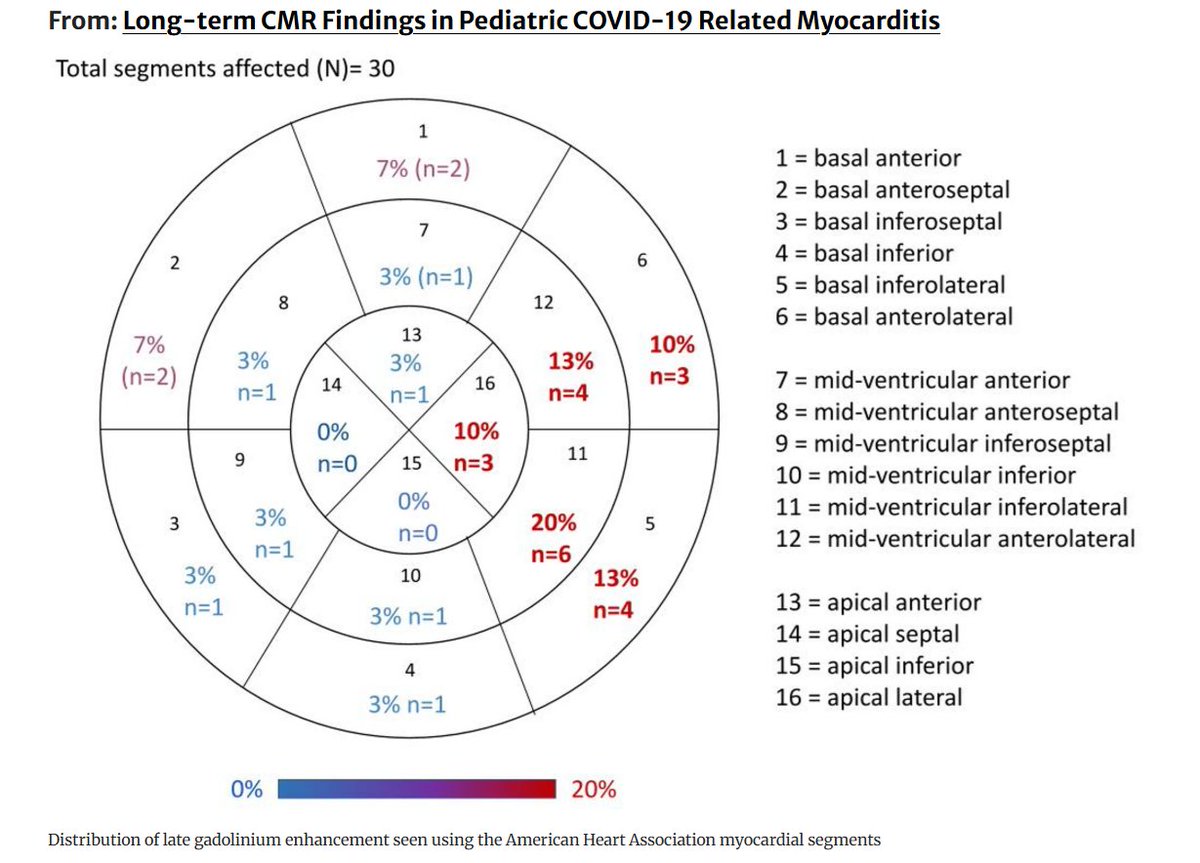 HarrySpoelstra's tweet photo. Long-term CMR Findings in Pediatric COVID-19 Related Myocarditis

🚨Even when KIDS 'fully recover' from COVID myocarditis, demonstrate normal heart function and have no symptoms, new CMR data shows PERSISTENT microvascular damage in the heart that refuses to go away!💔

➡️A retrospective small USA single-center study analysed long-term cardiac magnetic resonance (CMR) findings in 21 paediatric patients (mean age 13.1 years, 57% male) with suspected COVID-19-related myocarditis or MIS-C,

➡️Thirty CMR studies were categorized as early (<30 days), mid-term (30–364 days), and long-term (≥365 days), with serial imaging in 8 patients (median follow-up 347 days),

➡️Diagnosis used the 2009 Lake Louise criteria (T2-weighted imaging for oedema, early gadolinium enhancement(EGE)for hyperaemia/capillary leak, and late gadolinium enhancement (LGE) for fibrosis/necrosis),

➡️Important findings:
- Oedema resolved completely on long-term and serial follow-up imaging (15% early → 0%),
- LGE declined markedly (46% early → 25% mid-term → 0% long-term) and persisted in only 13% (1/8) of serial cases, showing lateral wall predominance,
- Pericardial effusions resolved fully (46% → 0%),
- Biventricular systolic function remained normal on all follow-up scans,
- In stark contrast, EGE remained persistently high across all timepoints: 77% early, 83% mid-term, and 80% long-term. Among patients with serial CMR, EGE persisted in 88% (7/8) despite resolution of oedema, LGE, and effusions,
- 13% continued to meet Lake Louise criteria on follow-up: 1 out of the 8 children who had repeat heart scans (CMR) still showed enough abnormalities to be diagnosed with active myocarditis/ LGE (scarring),

➡️Limitations: well noted/single center/ larger prospective studies urgently needed!

➡️Over a median clinical follow-up of 20 months, there were no arrhythmias, heart failure symptoms, cardiac rehospitalizations, or mortality. Most CMR abnormalities improved with favourable medium-term outcomes, but persistent EGE was common.

‼️So, despite complete resolution of oedema, near-total disappearance of LGE and effusions, preserved ventricular function, and zero adverse clinical events, the near-universal persistence of EGE in these children reveals ongoing microvascular damage in the heart, a silent, enduring marker of residual hyperaemia and capillary leak that continues unabated beneath a facade of apparent recovery. This finding demands recognition that normal function and symptom-free status do not equate to myocardial health!
→ The microvascular injury persists as a potential long-term threat requiring vigilant, extended surveillance in paediatric COVID-19 myocarditis survivors.
#AvoidSars2 #AvoidReinfections #ProtectChildren 
https://t.co/SxEUfc1wCN