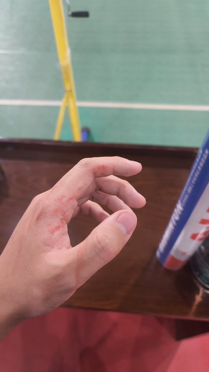 zfy6954's tweet photo. 球拍没拿稳成功给自己砍一刀... https://t.co/hPDKeq39Wk
