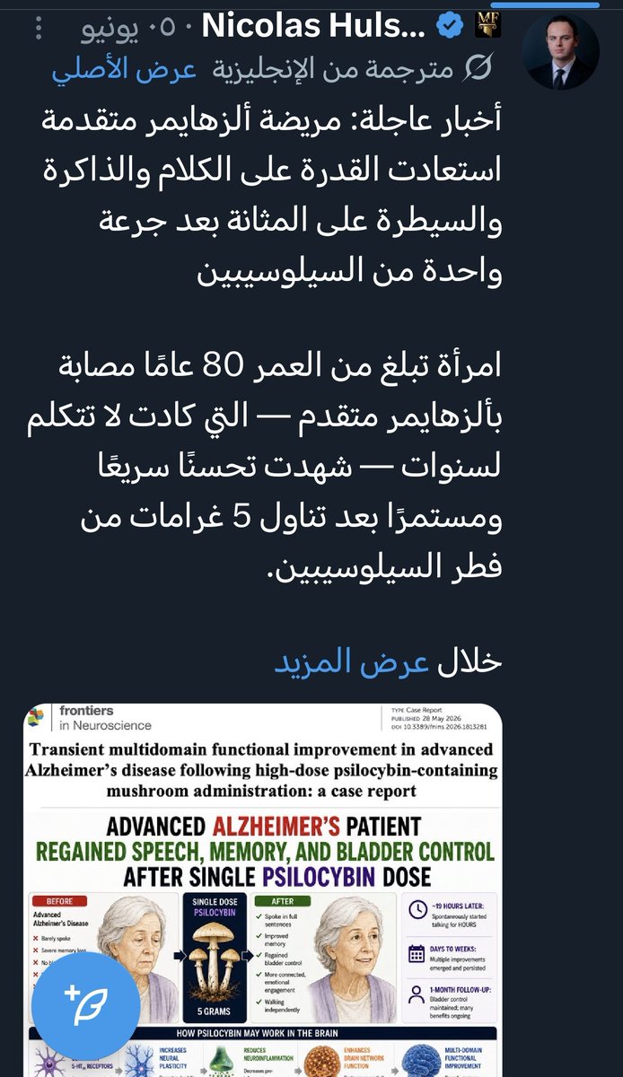 GasrMran's tweet photo. مركب psilocybin منع عام 1970 من قبل إدارة الرئيس نيكسون والان وبعد تصريح من رئيس ترامب تم إعطاء الضوء الأخضر التجارب والدراسات والبحث العلم تبين ان المادة فعال لعلاج بعض الاضطرابات المتعلقه بالمخ مازال البحث مستمر وقد يتم التصديق عليه في وقت لاحقا https://t.co/vdT2nzbIaS