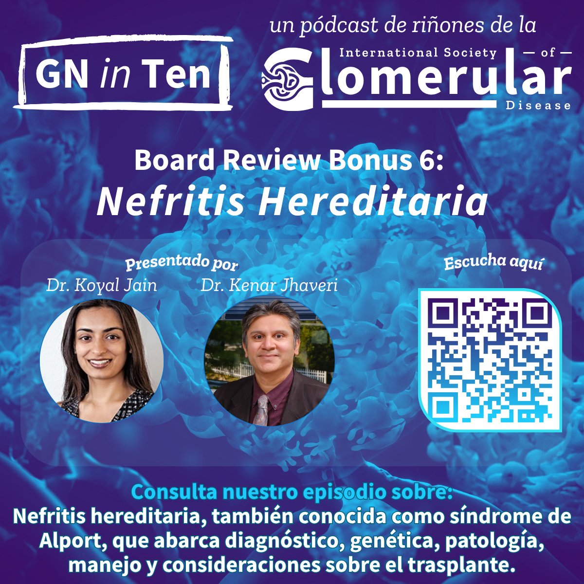 ISGD_la's tweet photo. 🚨 Nuevo GN in 10 🎙️
@kdjhaveri y @koyaljainMD ofrecen una revisión clínica completa de la nefritis hereditaria, también conocida como síndrome de Alport
🎧 Escucha aquí: https://t.co/vMGcsTjP6U
#NephTwitter #SindromeDeAlport #ISGD #GNin10 @Tobias_B_Huber @Barbara58932871 https://t.co/WL771eT9n4
