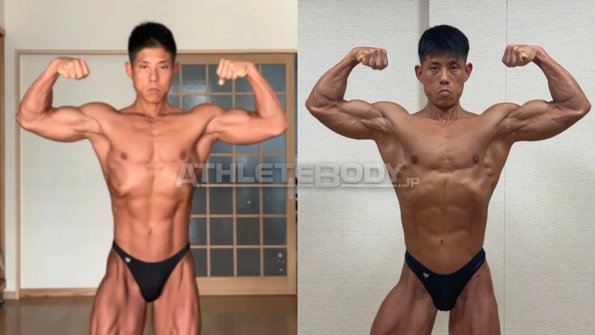 AthleteBodyjp's tweet photo. 毎週金曜日、フィットネス関連の情報をお送りしています。ぜひお付き合いください。

今日のテーマは、腕を太くするトレーニングです。

カッコいい身体を目指すトレーニングは、高重量のコンパウンド種目から始めるのが効率的です。

胸・背中・脚など、大きな部位の筋肉が成長することで、体形が分かりやすく変化していくことが多いです。

しかし、しばらくトレーニングを続けていると、全身が成長したのに対して腕が細く見える場面がよく出てきます。

今月、AthleteBodyのオンラインサロン「ボディビル道場」では、中級者以降の段階で腕を太くするための戦略を取り上げました。

AthleteBodyの大林は、腕トレを週6セットから18セットくらいまで増やしたことで大きな成果があったと言います。ただ、セット数を増やすと各部に痛みが出るようになり、関節の負担の少ない種目を選ぶようにしたとのことです。

大林はこの時期に腕まわりが4cm程度ほど太くなり、現在は45cmほどになりました。

鈴木雅さんは現役時に腕まわりが48cm（パンプ時には52cm）ほどありました。当時、腕を太くするためにセット数を増やしてみると疲労が抜けずに逆効果になったと感じたそうです。セット数を抑えて、質を高める工夫をすると効果があったとのことでした。

いずれの方法でも、疲労に注意しながら腕への刺激を増やすことがカギと言えそうです。

ちなみにAthleteBodyの選手でボディビル大会に優勝する人は、腕まわりが35cm以上、日本選手権のような高レベルの大会では40cm以上あることが多いです。（例外はあります。）

ただ、成果を急がず、長い目で続けることが必要です。AthleteBodyで腕を重視したプログラムを作ったケースを紹介します。

2年間の取り組みで、腕まわりが34cmから38cmに伸びました。前後比較の写真を添付しています。

この期間、選手個人に合った種目を選び、疲労に注意しながら徐々にセット数を増やすというプロセスを地道に続けていただきました。

2年と言うと長い時間ですが、実際には2年で腕まわりが4cm伸びるのは非常に良い成果です。1年に1cmくらいで十分に良い成果と言えるケースも少なくありません。

種目えらびのポイントは以下の通り。

■ 疲労と痛みが問題になりにくいこと
■ 可動域を大きく使えること
■ 狙った筋肉に負荷をかけやすいこと
■ 動作が複雑でないこと
■ 挙上成績を数字で管理しやすいこと
■ 腕は目に見える変化が出るまでに時間がかかるので、

挙上重量や回数で前進が捉えやすい種目をひとつ入れておくと判断材料として役立ちます。

腕に悩んでいるトレーニーの参考になれば幸いです。