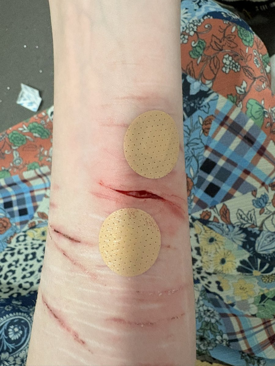 vivb4tz's tweet photo. ouch https://t.co/JcrbisCazE