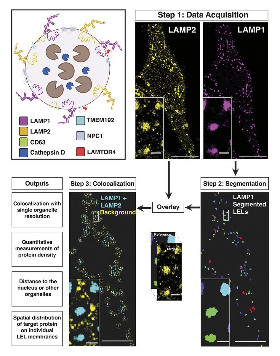 JCellBiol's tweet photo. Heterogeneity of late #endosome/#lysosomes shown by multiplexed DNA-PAINT imaging. Quantitative pipeline developed by Charles Bond, Melike Lakadamyali and colleagues: https://t.co/hUB1soQFHj 

📕 In #Lysosomes 2026: https://t.co/jTBR8w1ucY https://t.co/cqEBADjaK2