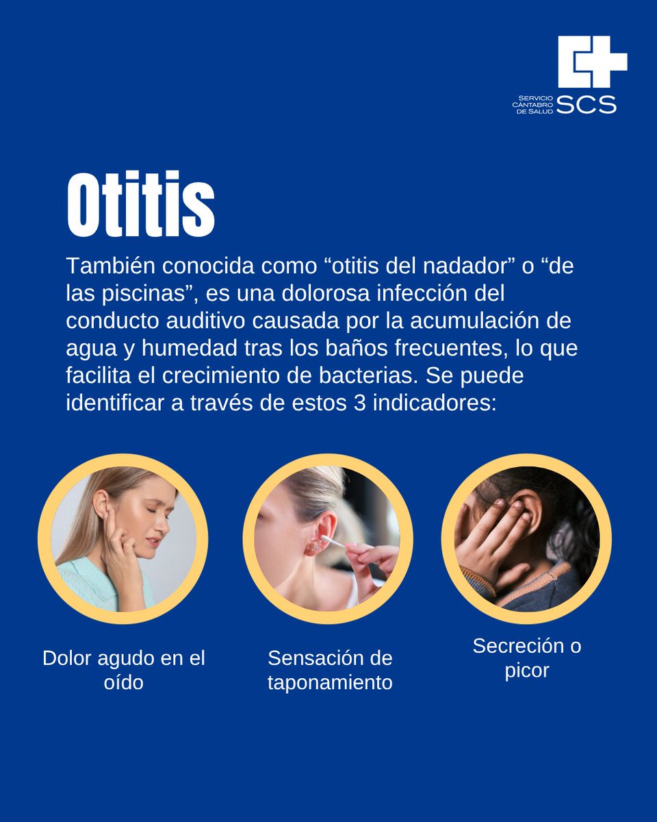scsalud's tweet photo. 🌊 En verano aumenta el riesgo de otitis por los baños en piscinas y playas. 🏊‍♂️

Detecta síntomas como dolor o taponamiento. Para prevenirla, seca bien tus oídos tras el baño y evita introducir objetos. 🛡️

💙 #SaludAuditiva #Otitis https://t.co/KfwZehQy6o