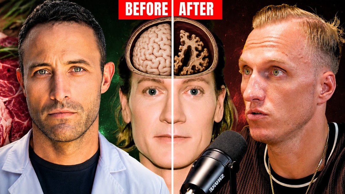 ChrisMMHealth's tweet photo. Surgeon: Bryan Johnson’s $2 Million Blueprint is Dangerous [Brain &amp; Dementia]

👉 https://t.co/RJSj0rGm75 [click] https://t.co/bvcOS4OSmp