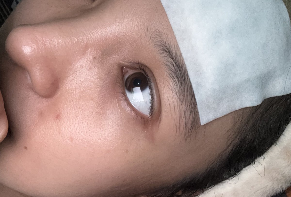 bluszean's tweet photo. ini gimana besop kalo hari ini demam😫💔 https://t.co/yIBYzXDTRJ