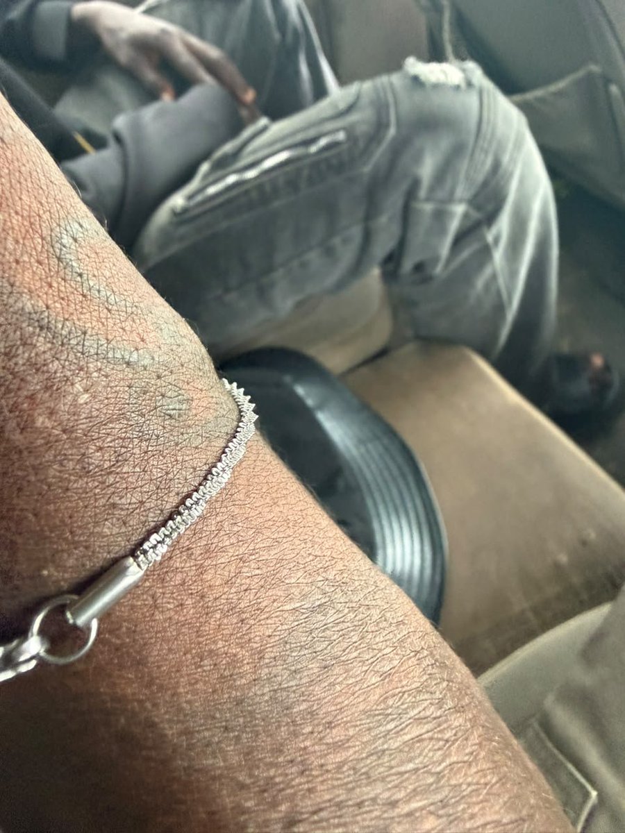 YXMFACTORY's tweet photo. @PoliceNG look at what the animals in Benin/Ugo road did to me and my manager this afternoon https://t.co/XoxLoYwlv2