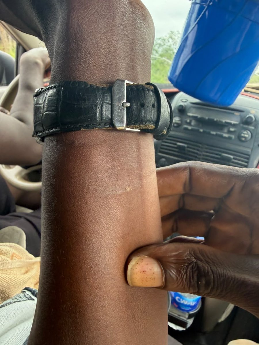 YXMFACTORY's tweet photo. @PoliceNG look at what the animals in Benin/Ugo road did to me and my manager this afternoon https://t.co/XoxLoYwlv2