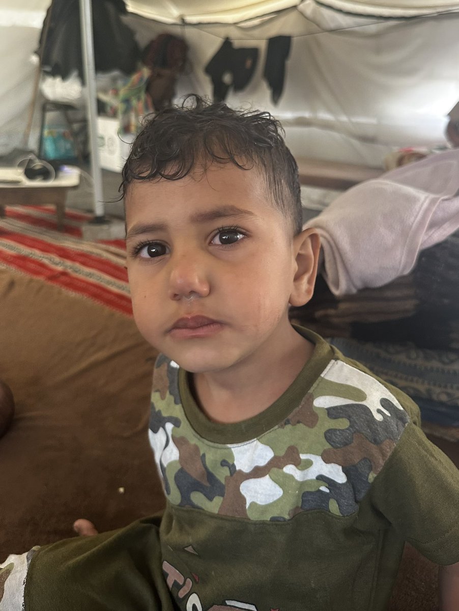 Tameralmasri90's tweet photo. Zain is home from the hospital today by the grace of God and your noble hearts! 🙏❤️ But "home" means returning to a cramped, suffocating tent that is fully infested with fleas, rats, and weasels. 
The nightmare isn't over. We haven't even raised half of our campaign goal. Zain needs expensive specialized food and treatment for his lung infection, severe stomach issues, and acute anemia. On top of that, my children are scratching their skin until they bleed due to the insect bites, requiring constant medical creams. 
I have 7 children to protect. Three are under 5, including my 4-month-old baby Layan who lacks milk and diapers. I am completely exhausted and lack the basic nutrition needed to stay strong for them. 
I apologize a million times for begging, but my pride is nothing compared to my children's lives. Please don't let a desperate mother's heart break. Help us complete Zain's treatment and secure our survival. 
Every donation counts. Please support us through the link below: ⬇️😭🏥🎪
https://t.co/Orc3jzkMiM 

@NatalieGABand @bill2earth @NasserIbnHamad @jccfergie @RioSlade @LuDoRight @AlbLunaa @lunalunabraga @don_vulpine @ERubio11091 @motherhongjoong @ssuzie__ @realJessicaW @BlackBerner2020 @Bruller19 @PauletteAlt @AliSubul15119 @stephenfaigen @TaiyangPK @flrainh @HorrorGorl @MelkiJRussell @mirsalah @AngryHamhock @KlonnyPin_Gosch @pampa_gonzalez @7gmatematik7g @Calas_Gaby @BlaqAsssFilm @ShinyFluffdnd @mearajbhagad @mirsalah @RadioWatermelon @DonnaPlageman @ChrisFo98725734 @Cristiano @lvn_crypto @cryptobrough