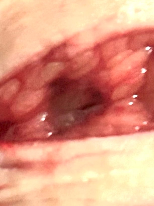 mysxees's tweet photo. is this fascia? this is just sfx makeup, i’m a makeup artist. #998twt #shtwt #slittertwitter #twtsh #slittwt
#slittertwt #shedtwt #subtwt #cutspo FAKE BLOOD FAKE BODY SFX MAKEUP FOR HALLOWEEN PURPOSES !!!!!BLOCK DONT REPORT!!!!! https://t.co/dDQmUf0ZVh