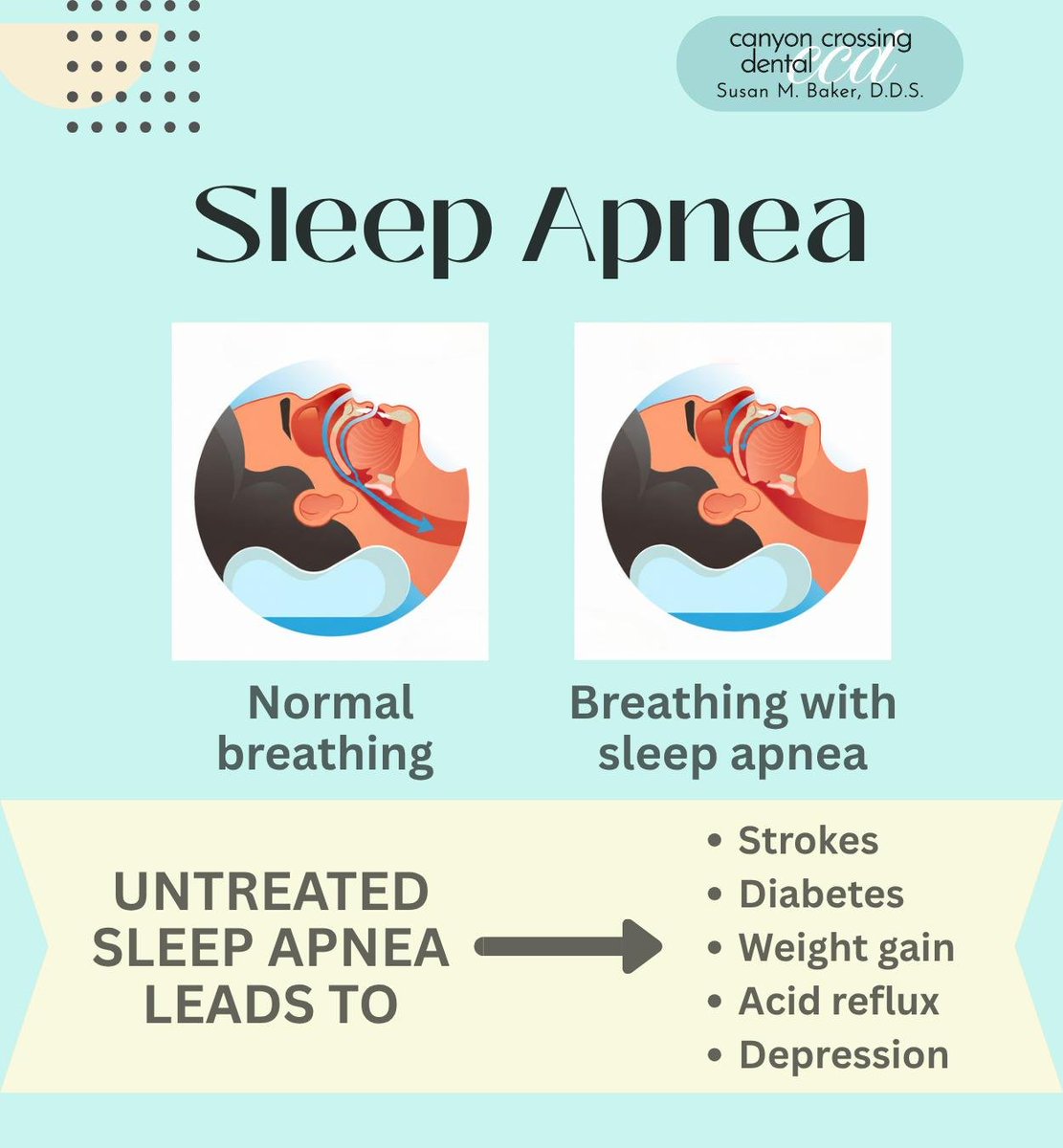 DrSusanBakerC's tweet photo. Sleep apnea is a serious condition that can lead to poor sleep and health problems. Don’t ignore symptoms; find the right treatment and take charge of your health today.
.
.
.
#sleepapnea #osa #bettersleep #CanyonCrossingDental #Ivins #UT https://t.co/DkYaMVQyNI