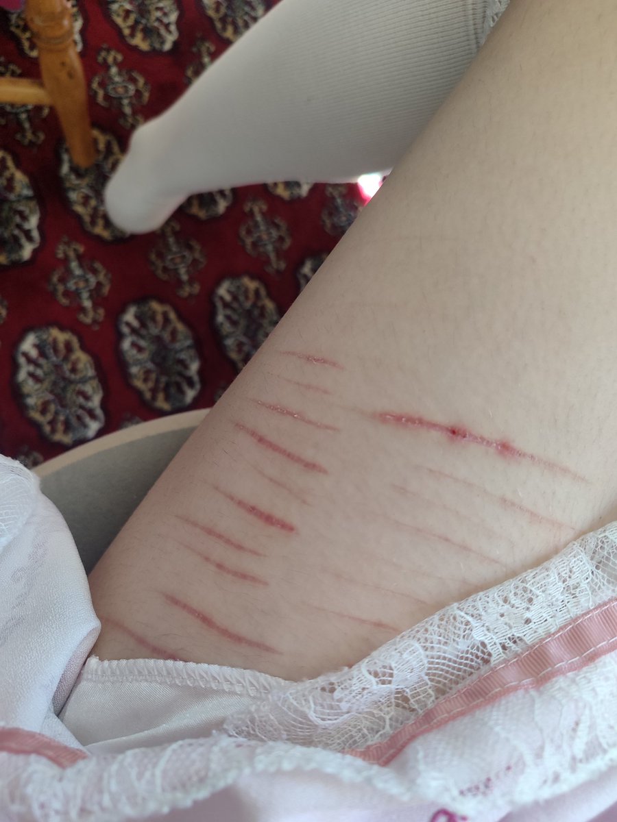 OnlyLoxxx's tweet photo. Scars, NOT REAL, MAKEUP, SFX, AI @shtwt @shedtwt https://t.co/odIjkDCpKO