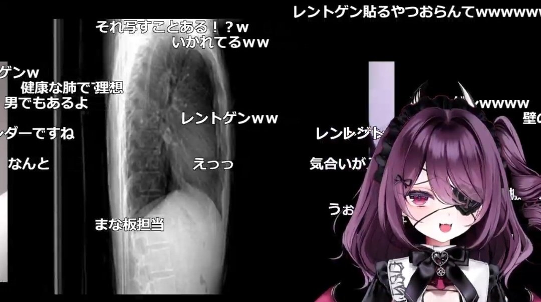 minamotoryoga's tweet photo. 過去にレントゲン写真を乗せたVTuberがいただろうか……
#運命メイナ初配信 https://t.co/WlxK6rmqXe
