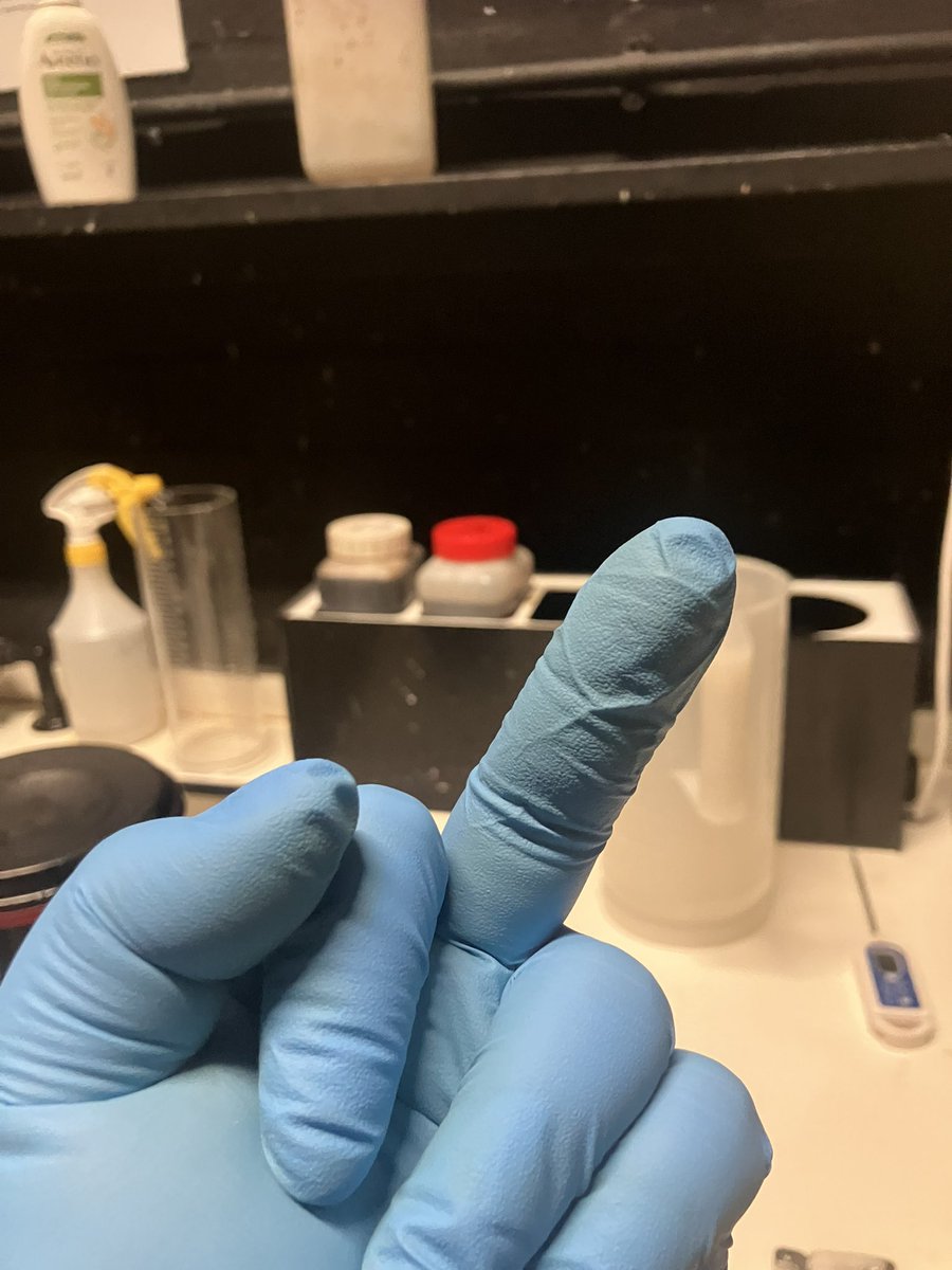 ArchiveEsthers_'s tweet photo. This roll of 5129 Vision 3 500T made me drop C-41 bleach on my trousers frick my Kodak Chudman life 😭😭😭 https://t.co/E7ETpwxqEr