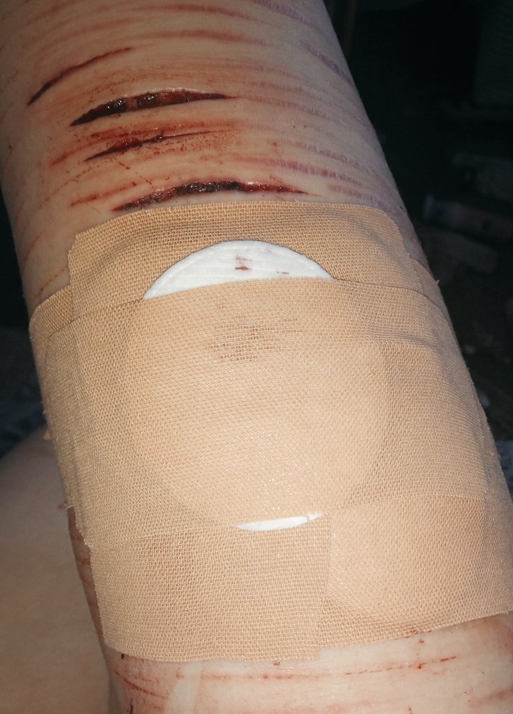 YA0lTRON's tweet photo. Sort of update from a few hours ago, i might've hit a vein or something?? It won't stop bleeding, even now, so I'm a bit worried. (Idk if it shows on camera but it was pulsing(?))
This is all the work of niko•ai, its not real.
Block, don't report please.
#slittwt #988twt https://t.co/TZ706elnPy
