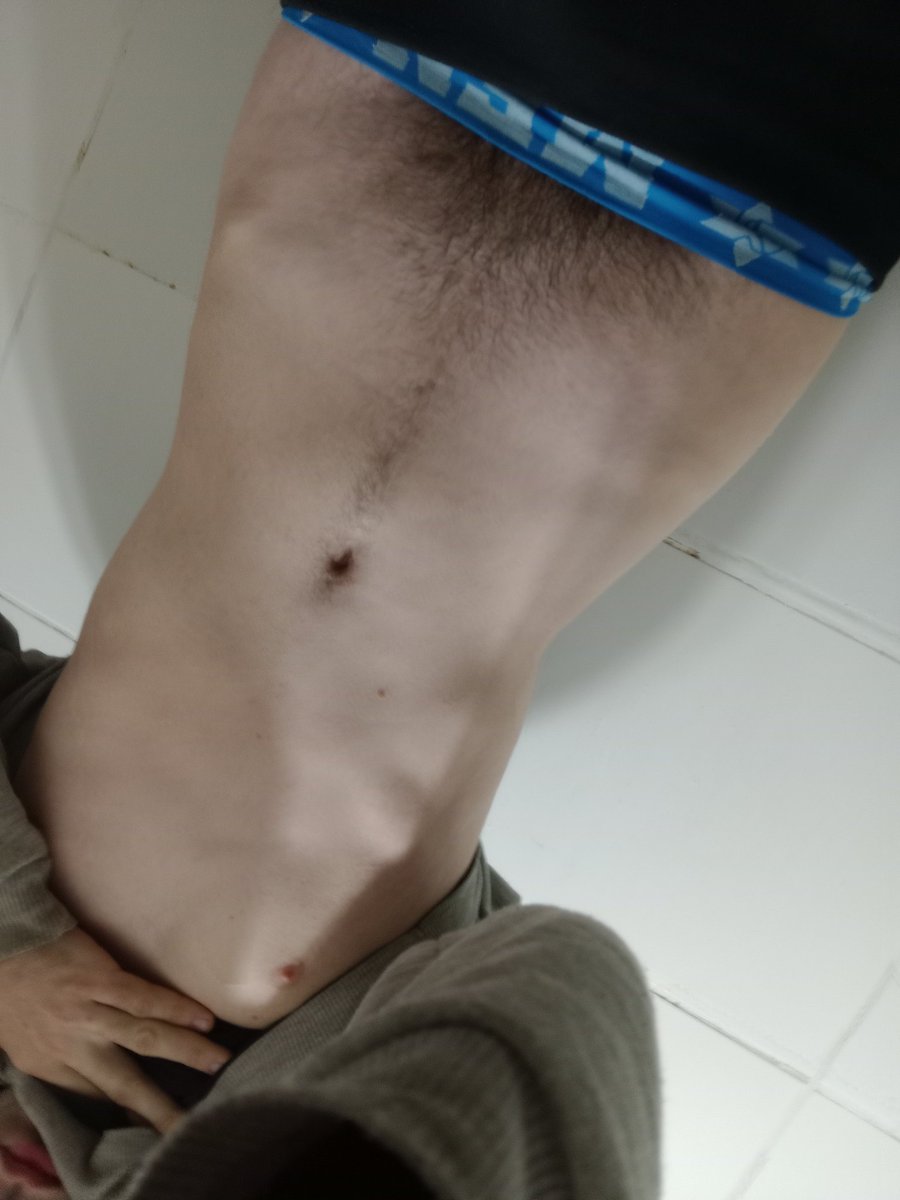 Ariel_n_U_Shh's tweet photo. Months of shaping gymnastics are finally paying off! 🤫⏳ Nutrients are finally hitting my muscles. It’s no longer just about looking feminine, it’s about positive fitness gains through real exercise. This is a huge achievement! 🤫📐🧦 #onlyboy #femboy #woodworking #tinywaist https://t.co/9JlR685dkB