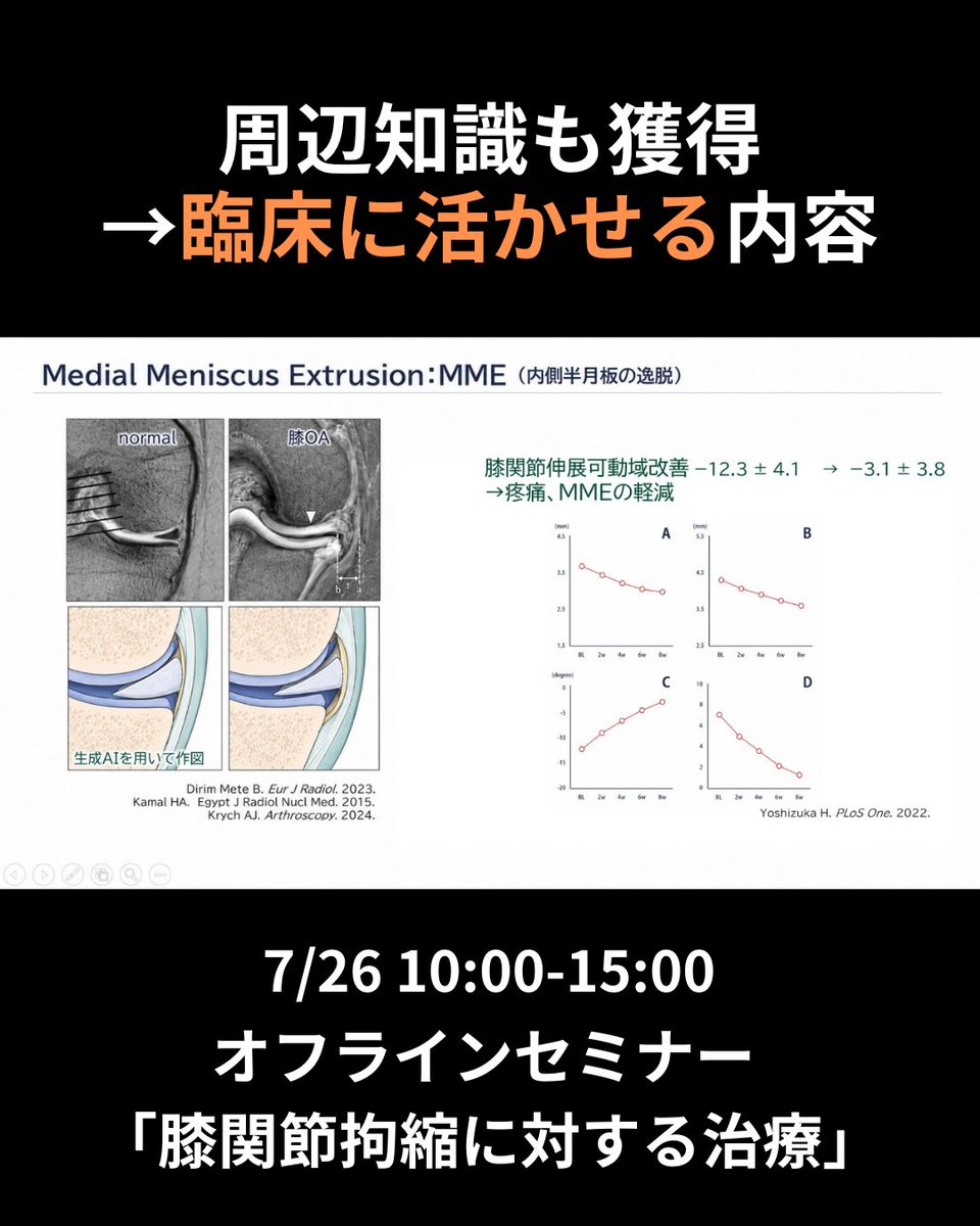 Thera_school's tweet photo. 【オフライン開催】
📣膝関節拘縮に対する治療実践
🗓️7/26 10:00-15:00
👨‍🏫久我友也先生

膝関節拘縮の治療ポイントやエコー下を用いた評価など
先生の治療や評価を間近で学べます📝
この機会にぜひご参加ください！https://t.co/Cf4qICdJGV https://t.co/9VfRslIe4V