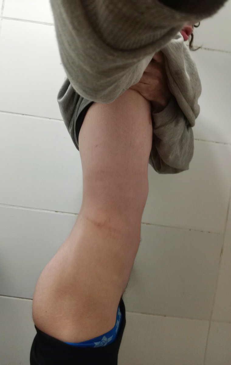 Ariel_n_U_Shh's tweet photo. Months of shaping gymnastics are finally paying off! 🤫⏳ Nutrients are finally hitting my muscles. It’s no longer just about looking feminine, it’s about positive fitness gains through real exercise. This is a huge achievement! 🤫📐🧦 #onlyboy #femboy #woodworking #tinywaist https://t.co/9JlR685dkB