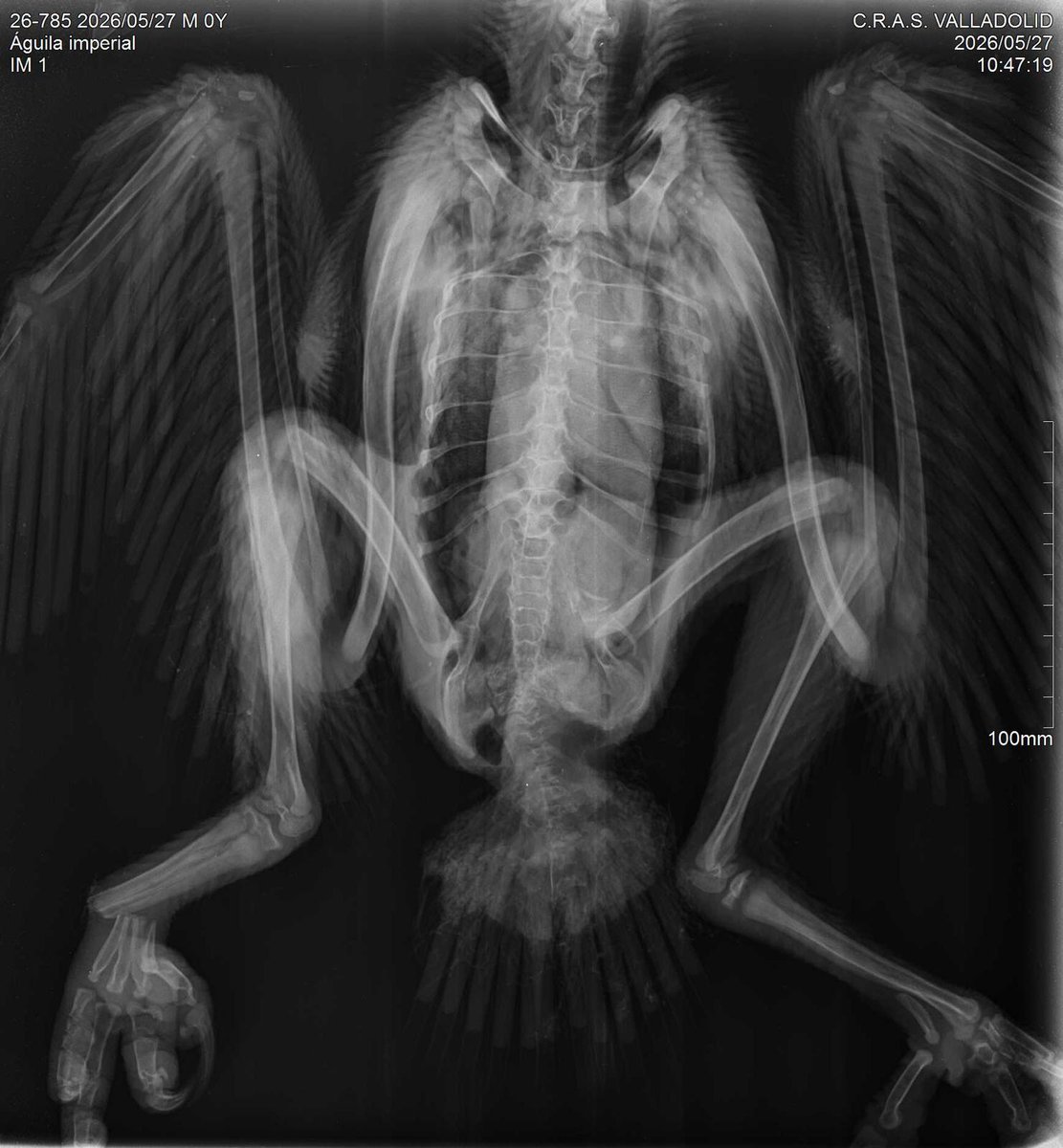 naturalezacyl's tweet photo. ¡Ya está dando sus primeros pasos!
Este pollo de #ÁguilaImperial, fue recogido bajo el nido el 27 de mayo con una fractura de tibia, en Portillo #Valladolid.
Es una alegría comprobar qué rápida va su recuperación para que pueda volver a la naturaleza cuanto antes #CRAS 👏👏 https://t.co/GqAaSkMA8x