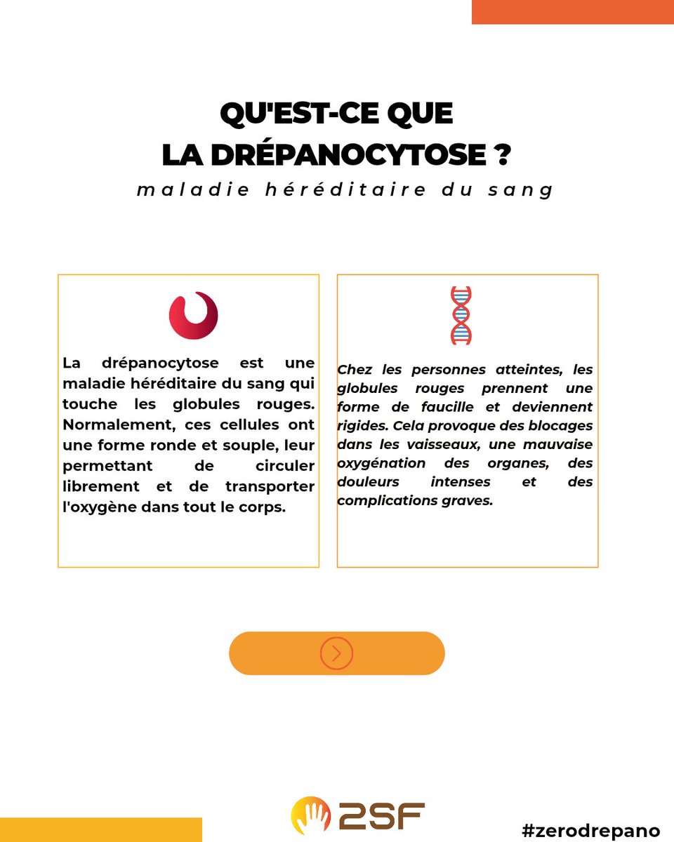 2sf_ong's tweet photo. La drépanocytose est la maladie génétique la plus répandue au monde.
Et pourtant, l'une des moins connues.
Derrière les chiffres, il y a des guerriers et guerrières qui se battent chaque jour, souvent en silence. https://t.co/iRsWgZaMh0