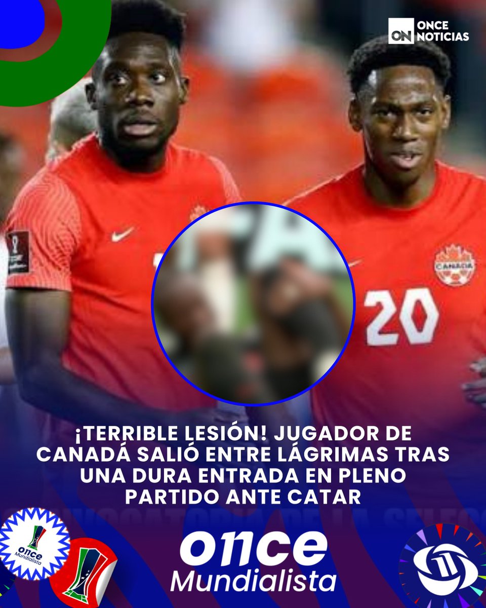 canal11hn's tweet photo. 😬🙅🏻♂️ ¡Carcel total! Jugador de Canadá sufre grave lesión tras fuerte entrada en pleno partido ante Catar 🤦🏻♂️. ¿Quién es?
Todos los detalles aquí 👉🏻: https://t.co/XMOk8ktzmi
#Lesion #Canada #Qatar #Futbol #United2026 https://t.co/1tndNpiml0