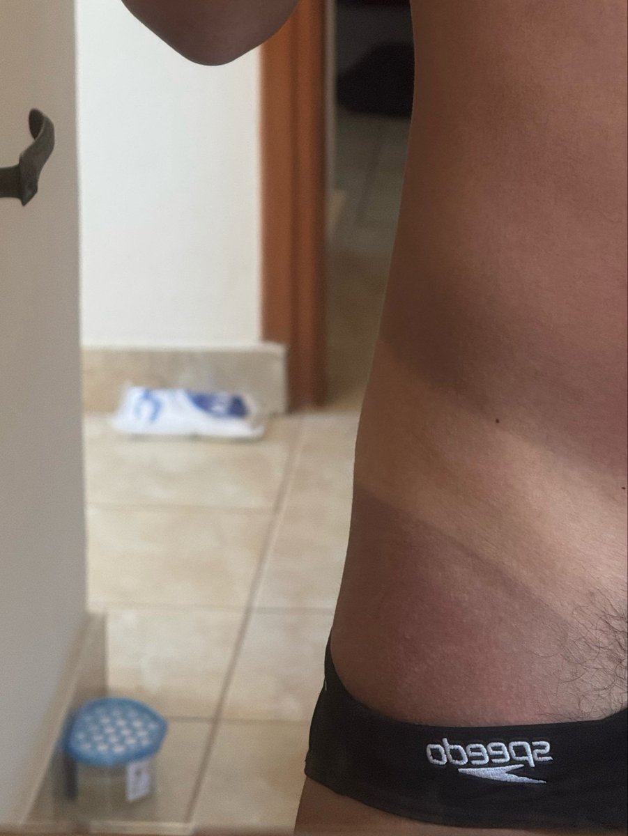cameronmurphy_'s tweet photo. Fell asleep in the sun…. Not mad at it though https://t.co/t4UE0RYIK1