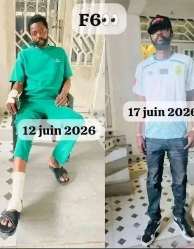 Jeanbertin6573's tweet photo. @MarleyVuvu Voilà tu nous montre ta vraie nature en politique. Tu n'es en politique que pour laver tant que tu peux le nom de ton maître le 🐕 de kagame. Comment on pouvait orchestrer un mensonge à l'égard de celui qui était à la tête du pays que toi tu vis et que toi aussi tu crois à ça? https://t.co/1t4sRjV1V0