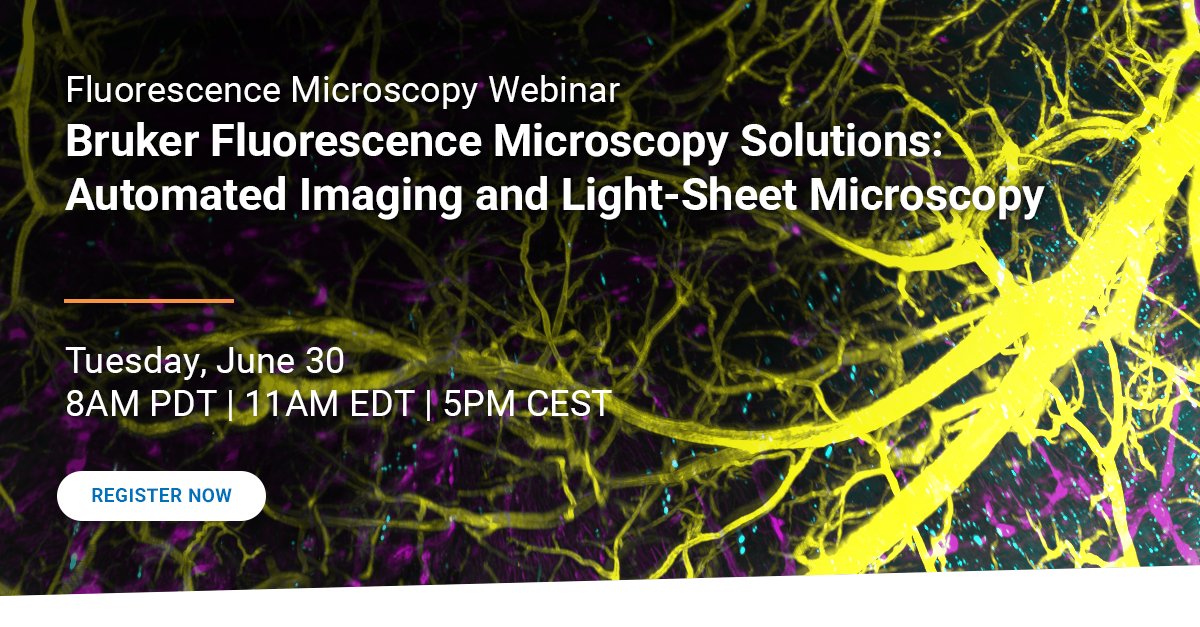 BrukerFM's tweet photo. 🖥️ Automated Imaging and Light Sheet Microscopy
▶️ https://t.co/xhgB5NqN24

This webinar presents the Bruker Luxendo imaging ecosystem, which connects automated #microscopy, light-sheet #imaging, and high-performance #data infrastructure into a cohesive, scalable workflow. https://t.co/rA7mGujF4z