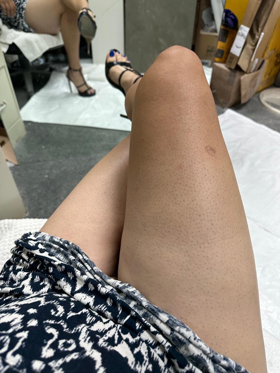 BiSupporter's tweet photo. Freshly moisturized https://t.co/OdhigupqwW