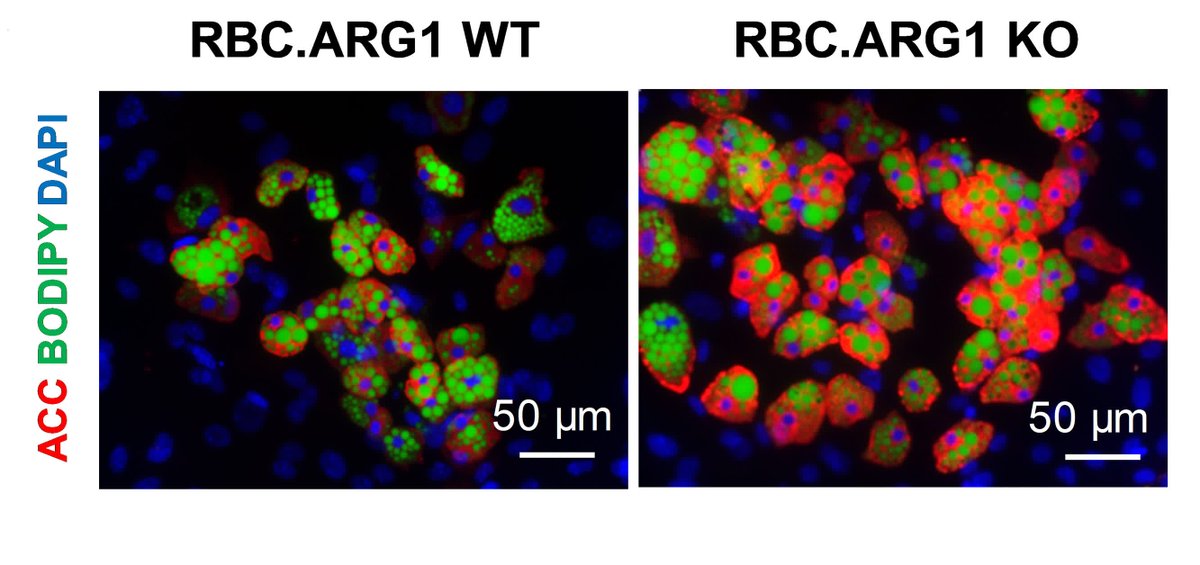 CircRes's tweet photo. Sun &amp; colleagues show that excess #NO from #erythrocytes drives lipid accumulation in #VSMCs, accelerating plaque formation in #arteries. Learn more about a key mediator of #atherosclerosis at https://t.co/2uCG5LxOZm
@PhilippLurz https://t.co/gRjdid8HD2