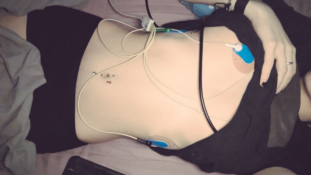 totenuous's tweet photo. do u like my cables https://t.co/bMQ3EocLKx