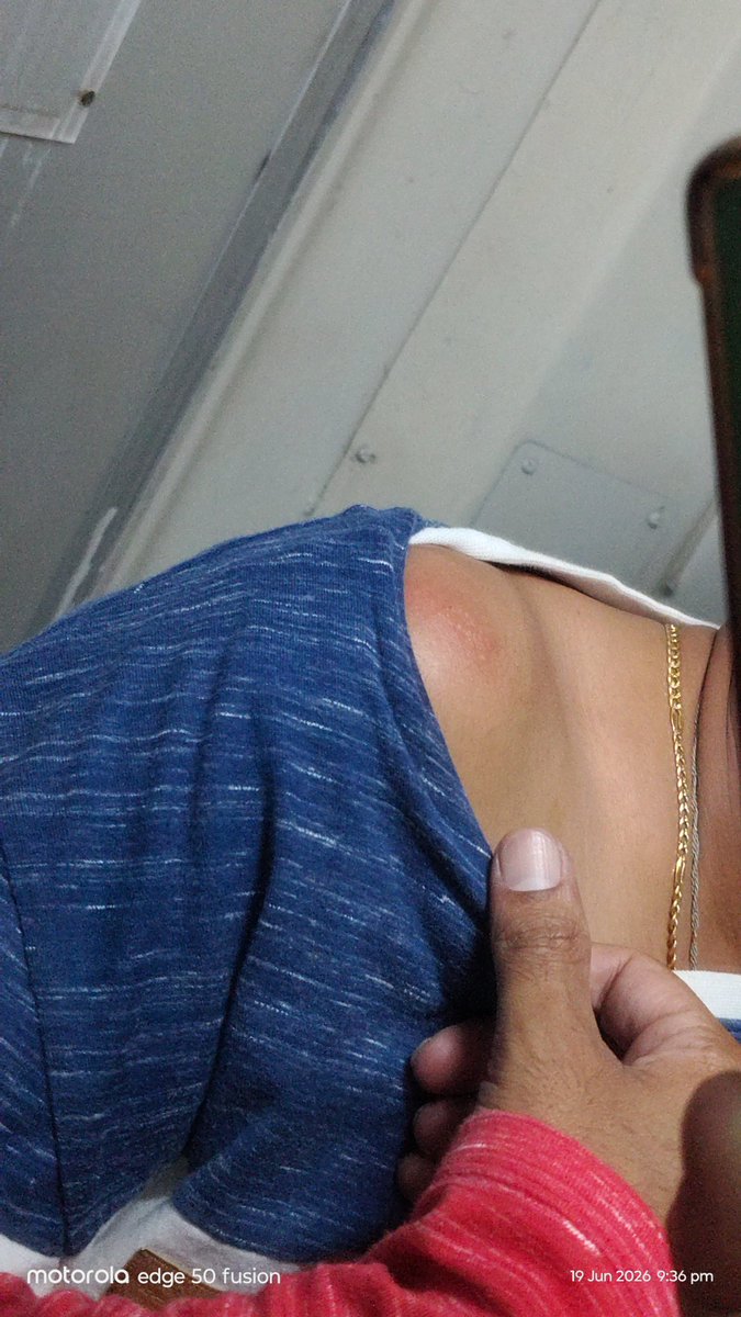 Amar4Change's tweet photo. @RailMadad @RailMinIndia @RailwaySeva I got hit by this seat, while opening the door it fell on my shoulder and face, nothing major happened but got bruises and scratches lucky to survive major injury. Can you take appropriate action to fix this. 
Trn:16583 YPR to BIDR https://t.co/fxuOlQxJVu